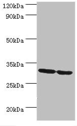 Western blot. All lanes: PNP antibody at 10µg/ml. Lane 1: Jurkat whole cell lysate. Lane 2: K562 whole cell lysate. Secondary. Goat polyclonal to rabbit IgG at 1/10000 dilution. Predicted band size: 32 kDa. Observed band size: 32 kDa