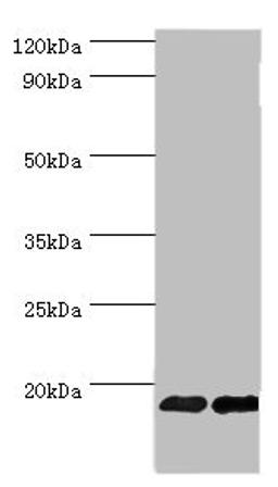 Western blot. All lanes: Fibroblast growth factor 1 antibody at 6ug/ml. Lane 1: Mouse kidney tissue. Lane 2: Mouse heart tissue. Secondary. Goat polyclonal to rabbit IgG at 1/10000 dilution. Predicted band size: 18, 7 kDa. Observed band size: 18 kDa. 