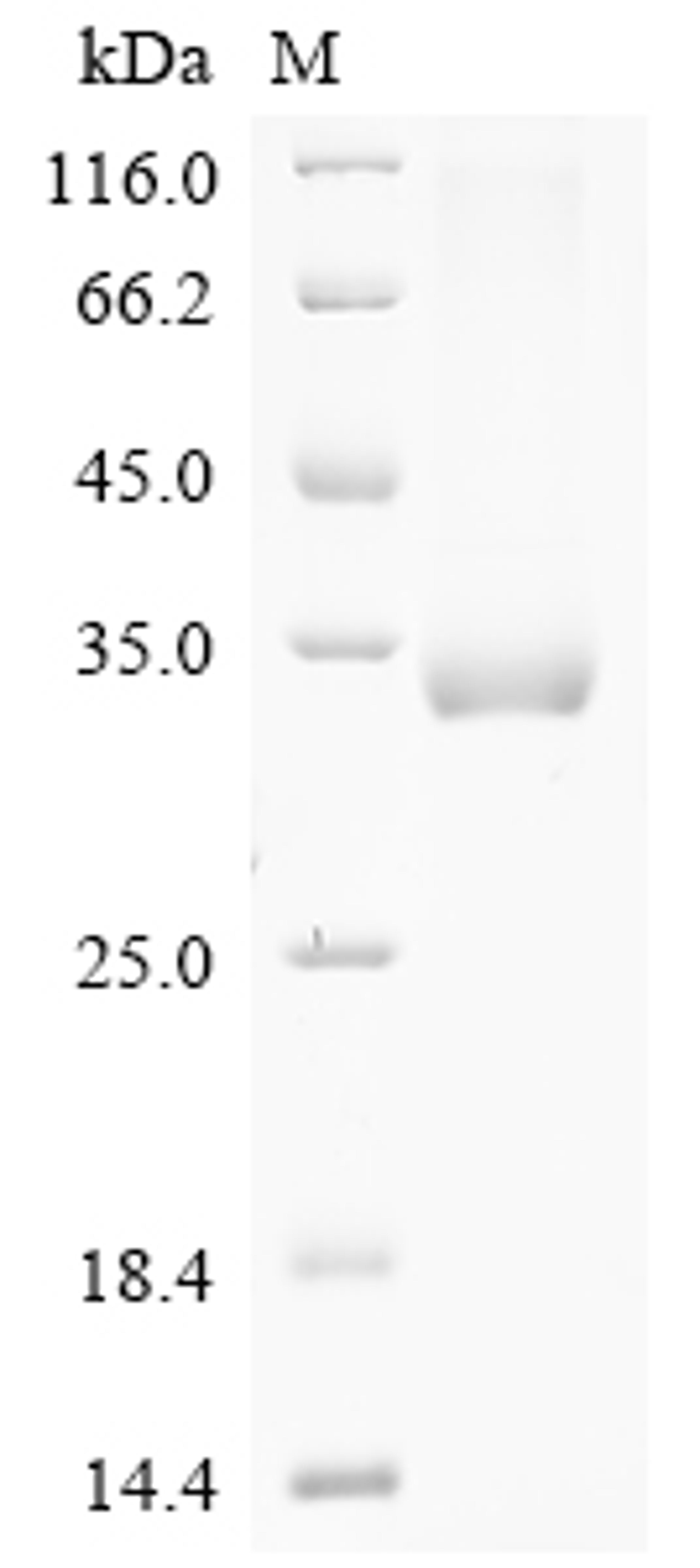(Tris-Glycine gel) Discontinuous SDS-PAGE (reduced) with 5% enrichment gel and 15% separation gel.