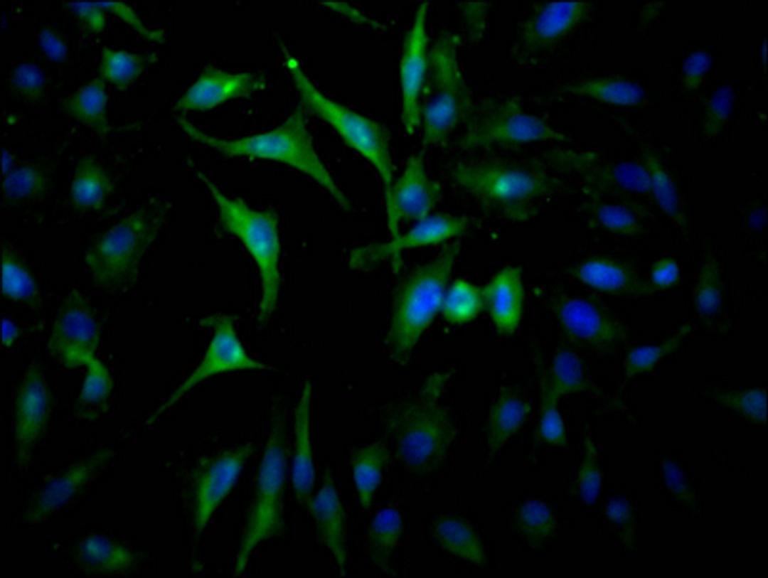 Immunofluorescence staining of Hela Cells with CSB-RA267127A0HU at 1:50, counter-stained with DAPI. The cells were fixed in 4% formaldehyde, permeated by 0.2% TritonX-100, and blocked in 10% normal Goat Serum. The cells were then incubated with the antibody overnight at 4℃. Nuclear DNA was labeled in blue with DAPI. The secondary antibody was FITC-conjugated AffiniPure Goat Anti-Rabbit IgG (H+L).