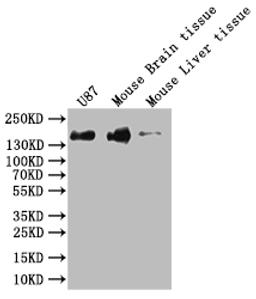 Western Blot. Positive WB detected in: Hela whole cell lysate, K562 whole cell lysate, U-87 whole cell lysate, Mouse Brain whole cell lysate. All lanes: SF3B1 antibody at 1:1000. Secondary. Goat polyclonal to rabbit IgG at 1/50000 dilution. Predicted band size: 146, 17 kDa. Observed band size: 130 kDa. 