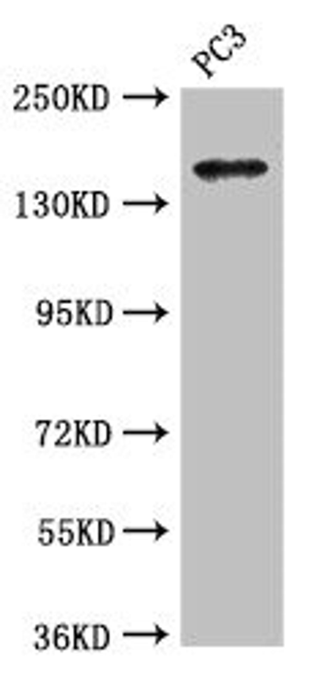 Western Blot. Positive WB detected in: PC-3 whole cell lysate. All lanes: ASTN2 antibody at 3.4µg/ml. Secondary. Goat polyclonal to rabbit IgG at 1/50000 dilution. Predicted band size: 149, 143, 148, 50, 45 kDa. Observed band size: 149 kDa