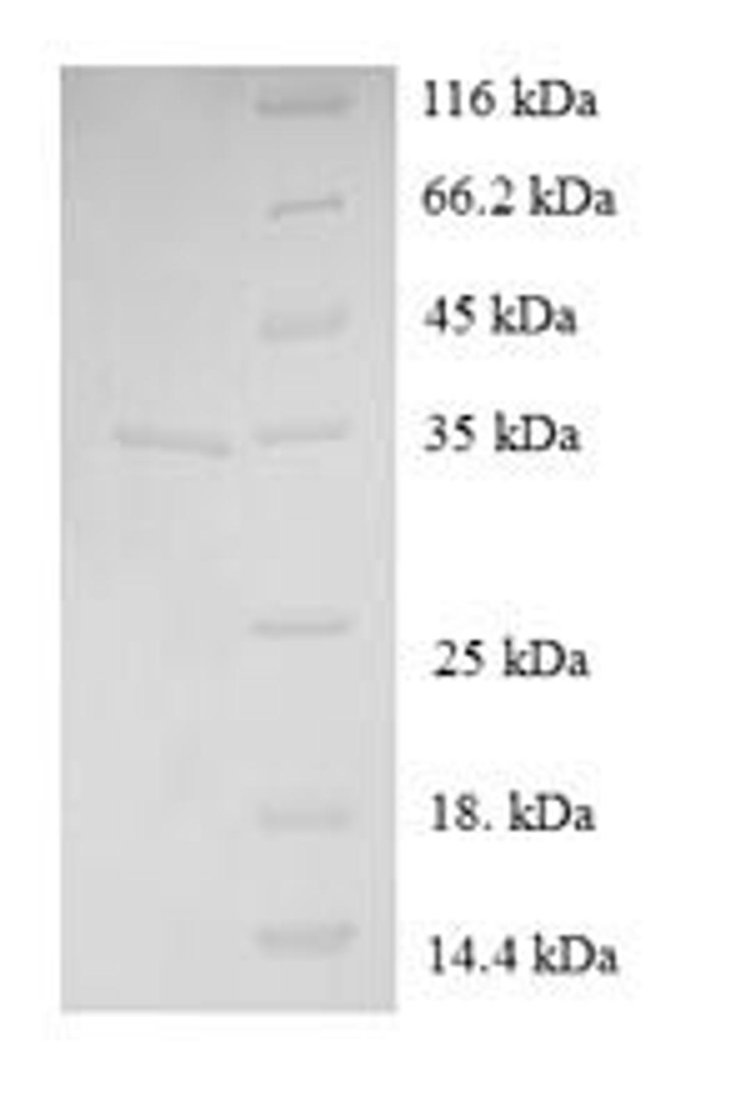 (Tris-Glycine gel) Discontinuous SDS-PAGE (reduced) with 5% enrichment gel and 15% separation gel.