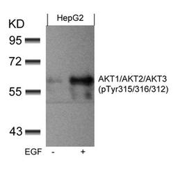 Western blot analysis of extracts from HepG2 cells untreated or treated with EGF using AKT1/AKT2/AKT3(phospho-Tyr315/316/312) Antibody.