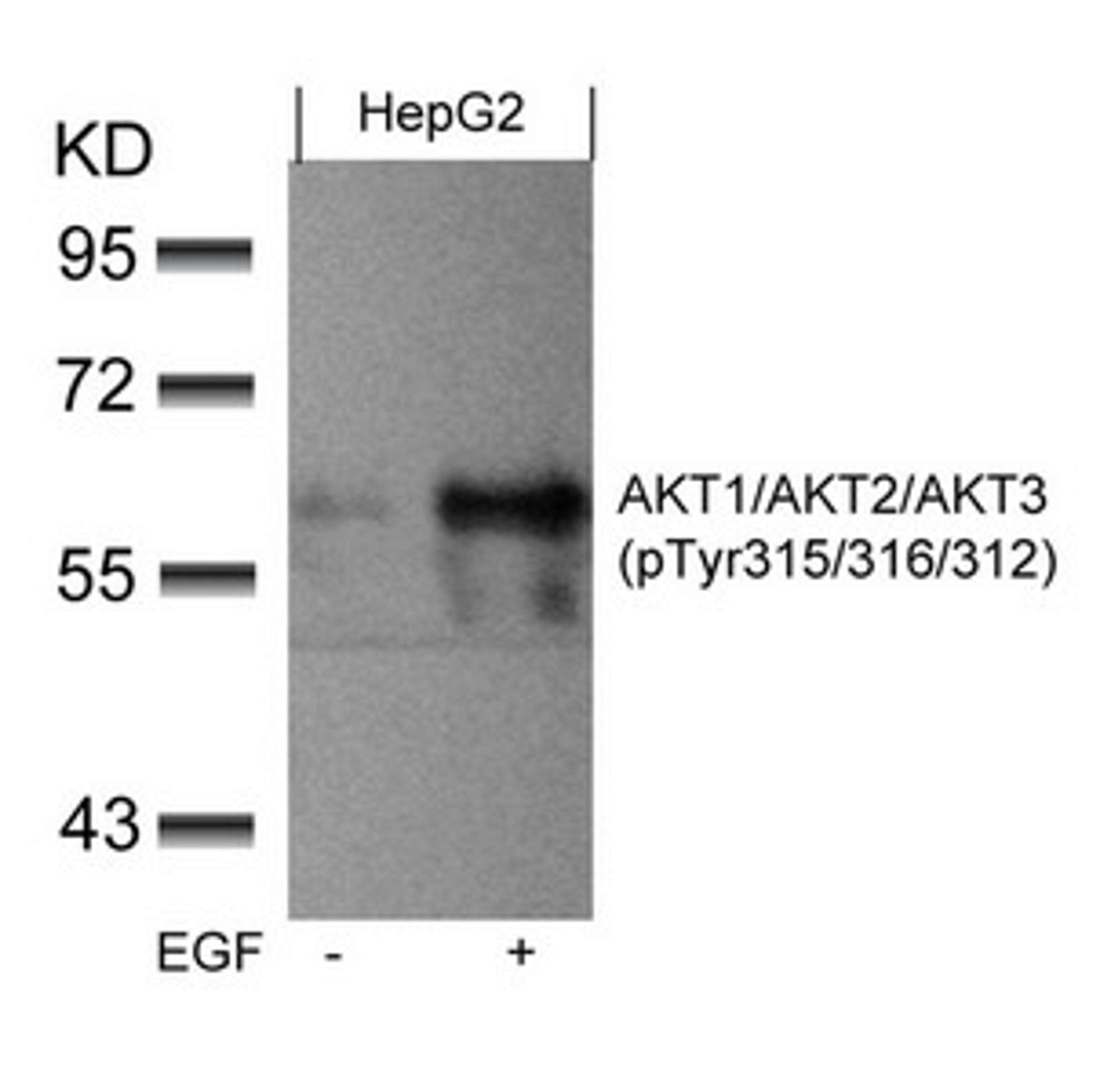 Western blot analysis of extracts from HepG2 cells untreated or treated with EGF using AKT1/AKT2/AKT3(phospho-Tyr315/316/312) Antibody.