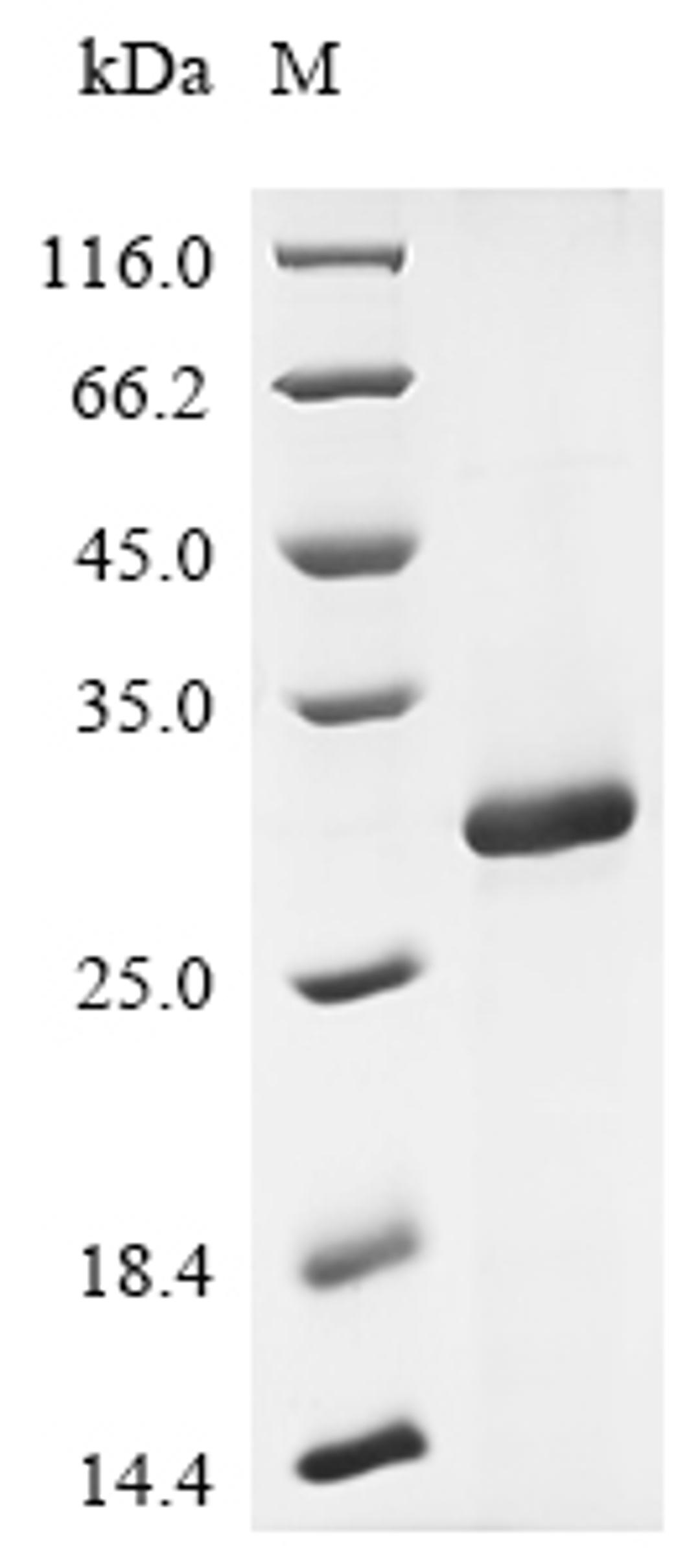 (Tris-Glycine gel) Discontinuous SDS-PAGE (reduced) with 5% enrichment gel and 15% separation gel.