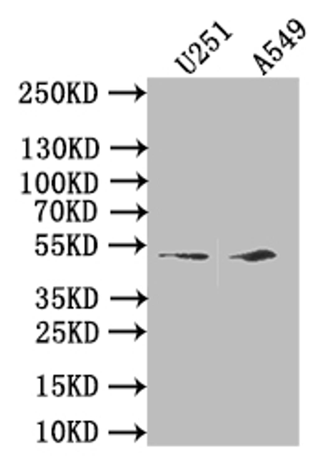 Western Blot. Positive WB detected in: HepG2 whole cell lysate, A549 whole cell lysate, NIH/3T3 whole cell lysate. All lanes: IFI44L antibody at 2.5µg/ml. Secondary. Goat polyclonal to rabbit IgG at 1/50000 dilution. Predicted band size: 52, 19 kDa. Observed band size: 52 kDa