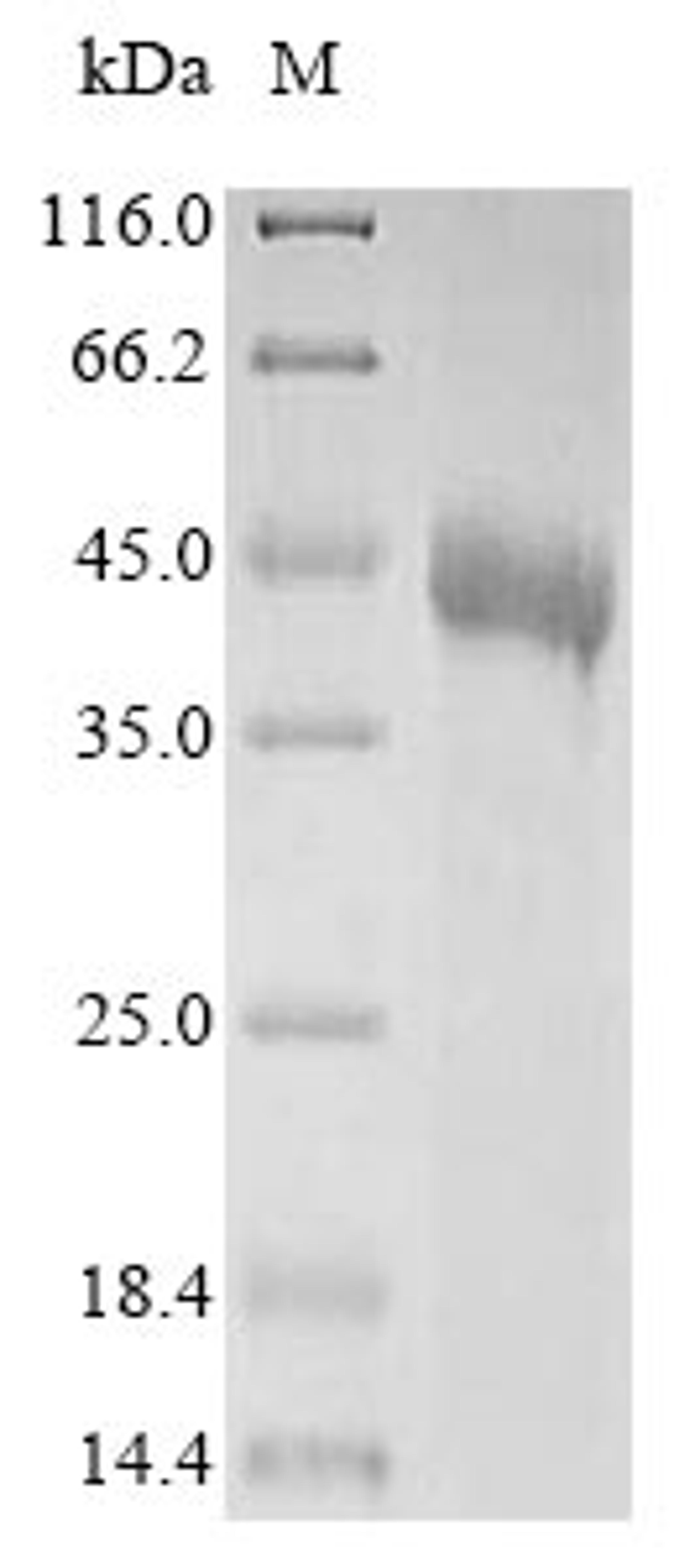 (Tris-Glycine gel) Discontinuous SDS-PAGE (reduced) with 5% enrichment gel and 15% separation gel.
