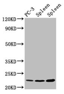 Western Blot. Positive WB detected in: PC-3 whole cell lysate, Rat spleen tissue, Mouse spleen tissue. All lanes: HIST1H1D antibody at 1.5µg/ml. Secondary. Goat polyclonal to rabbit IgG at 1/50000 dilution. Predicted band size: 23 kDa. Observed band size: 23 kDa