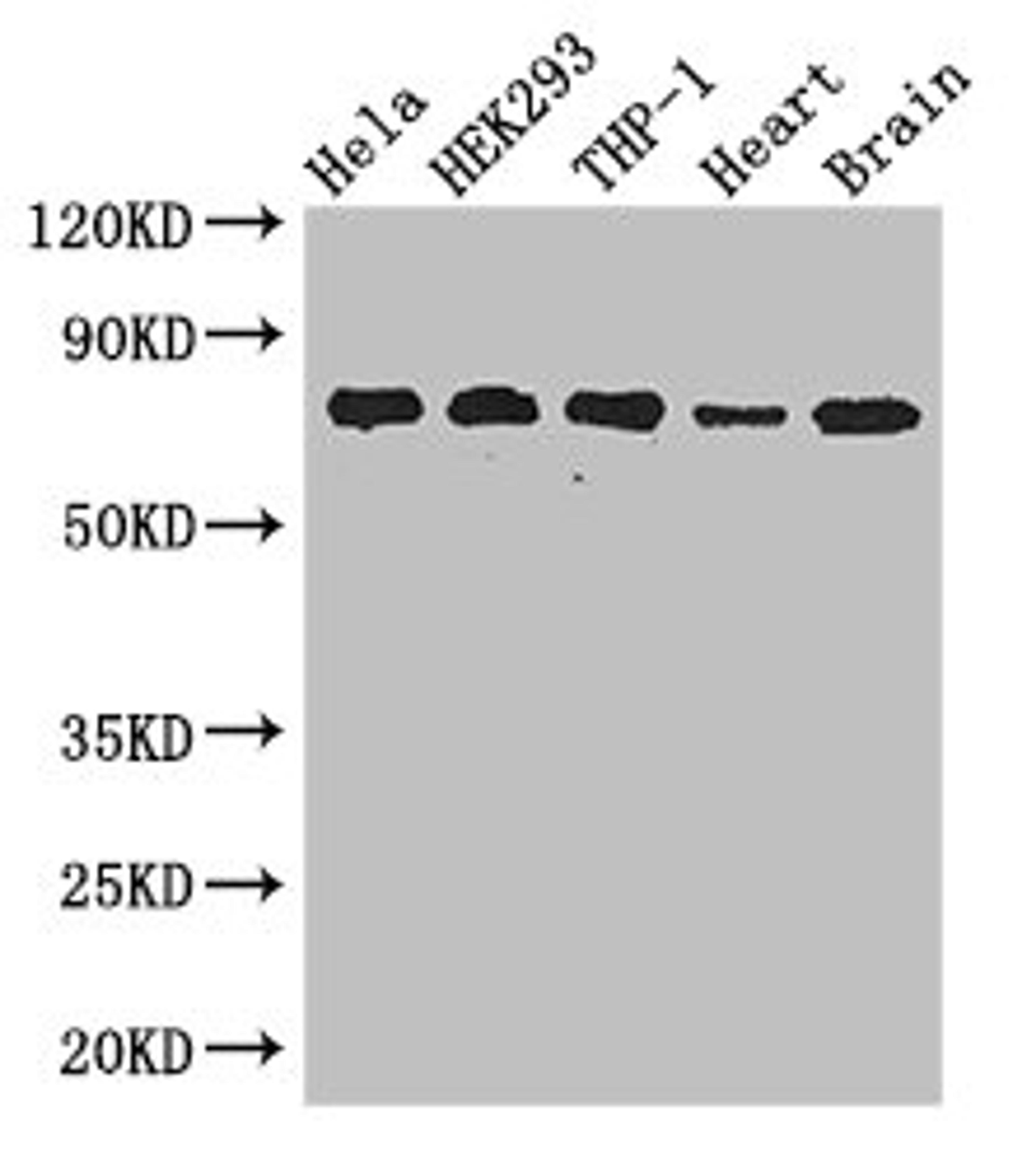 Western Blot. Positive WB detected in: Hela whole cell lysate, HEK293 whole cell lysate, THP-1 whole cell lysate, Mouse heart tissue, Mouse brain tissue. All lanes: FAF1 antibody at 2.8ug/ml. Secondary. Goat polyclonal to rabbit IgG at 1/50000 dilution. Predicted band size: 74, 57 kDa. Observed band size: 74 kDa. 