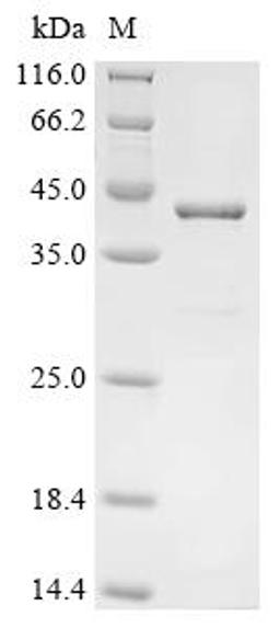 (Tris-Glycine gel) Discontinuous SDS-PAGE (reduced) with 5% enrichment gel and 15% separation gel.