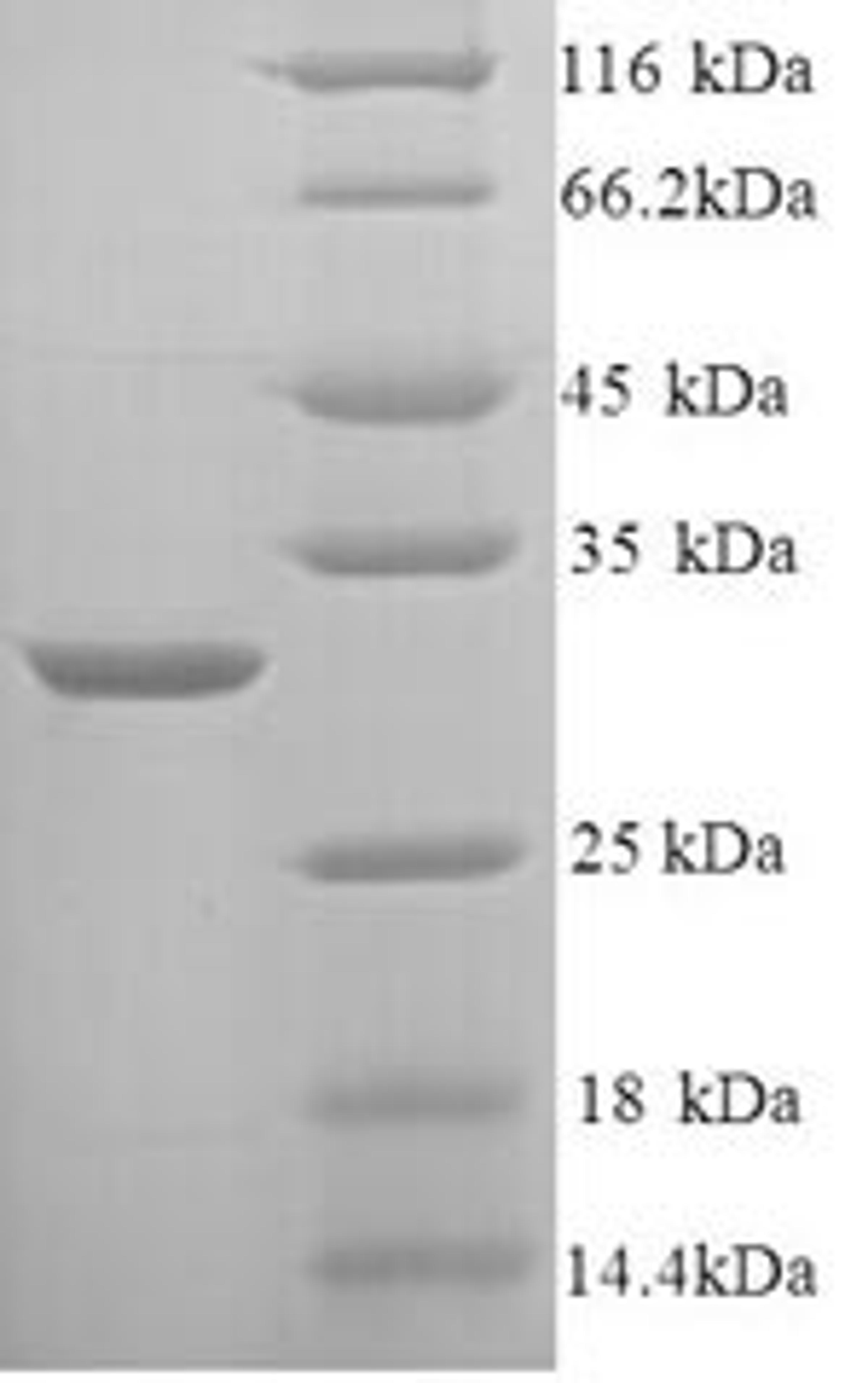 (Tris-Glycine gel) Discontinuous SDS-PAGE (reduced) with 5% enrichment gel and 15% separation gel.