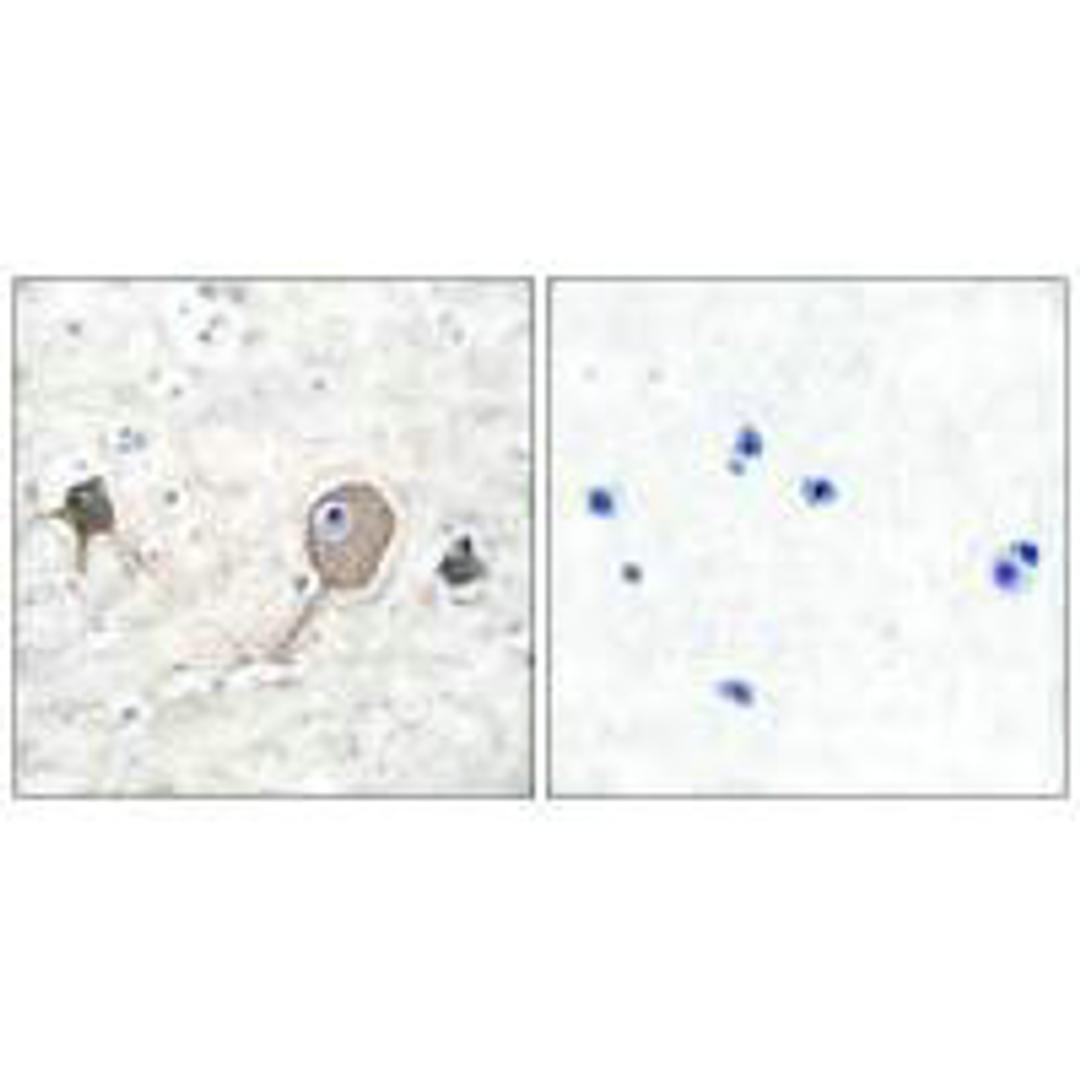 Immunohistochemical analysis of paraffin-embedded human brain tissue using NSE antibody.