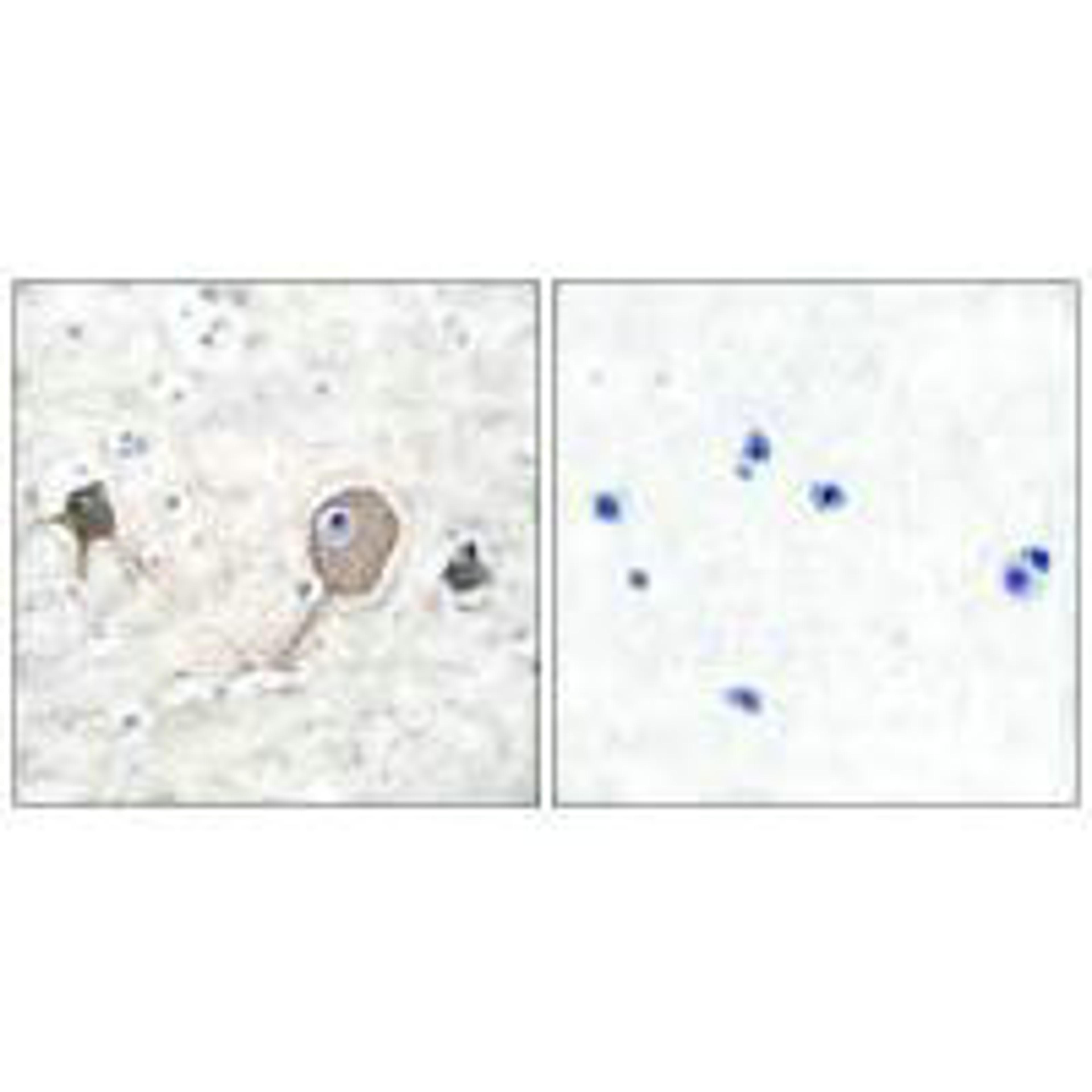Immunohistochemical analysis of paraffin-embedded human brain tissue using NSE antibody.