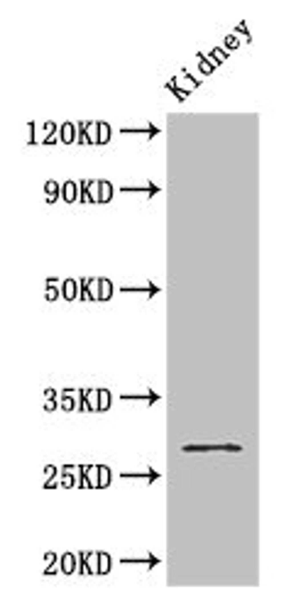 Western Blot. Positive WB detected in: Mouse kidney tissue. All lanes: GSTM3 antibody at 2.8ug/ml. Secondary. Goat polyclonal to rabbit IgG at 1/50000 dilution. Predicted band size: 27 kDa. Observed band size: 27 kDa. 