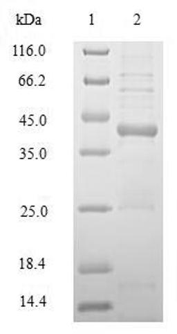 (Tris-Glycine gel) Discontinuous SDS-PAGE (reduced) with 5% enrichment gel and 15% separation gel.