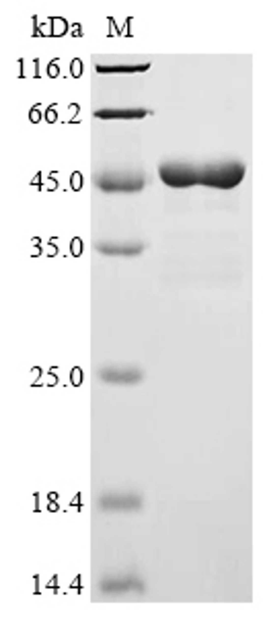 (Tris-Glycine gel) Discontinuous SDS-PAGE (reduced) with 5% enrichment gel and 15% separation gel.