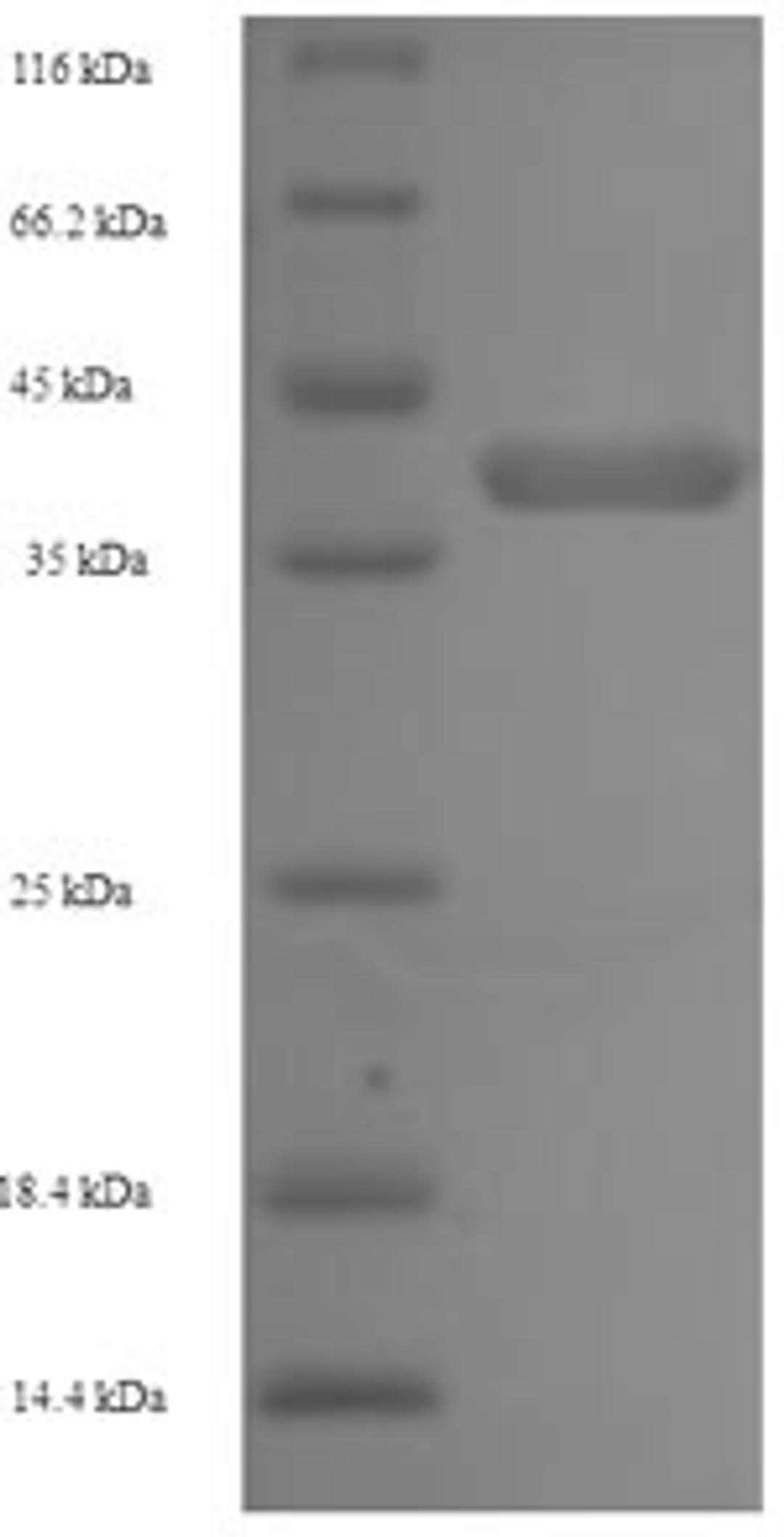 (Tris-Glycine gel) Discontinuous SDS-PAGE (reduced) with 5% enrichment gel and 15% separation gel.