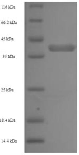 (Tris-Glycine gel) Discontinuous SDS-PAGE (reduced) with 5% enrichment gel and 15% separation gel.