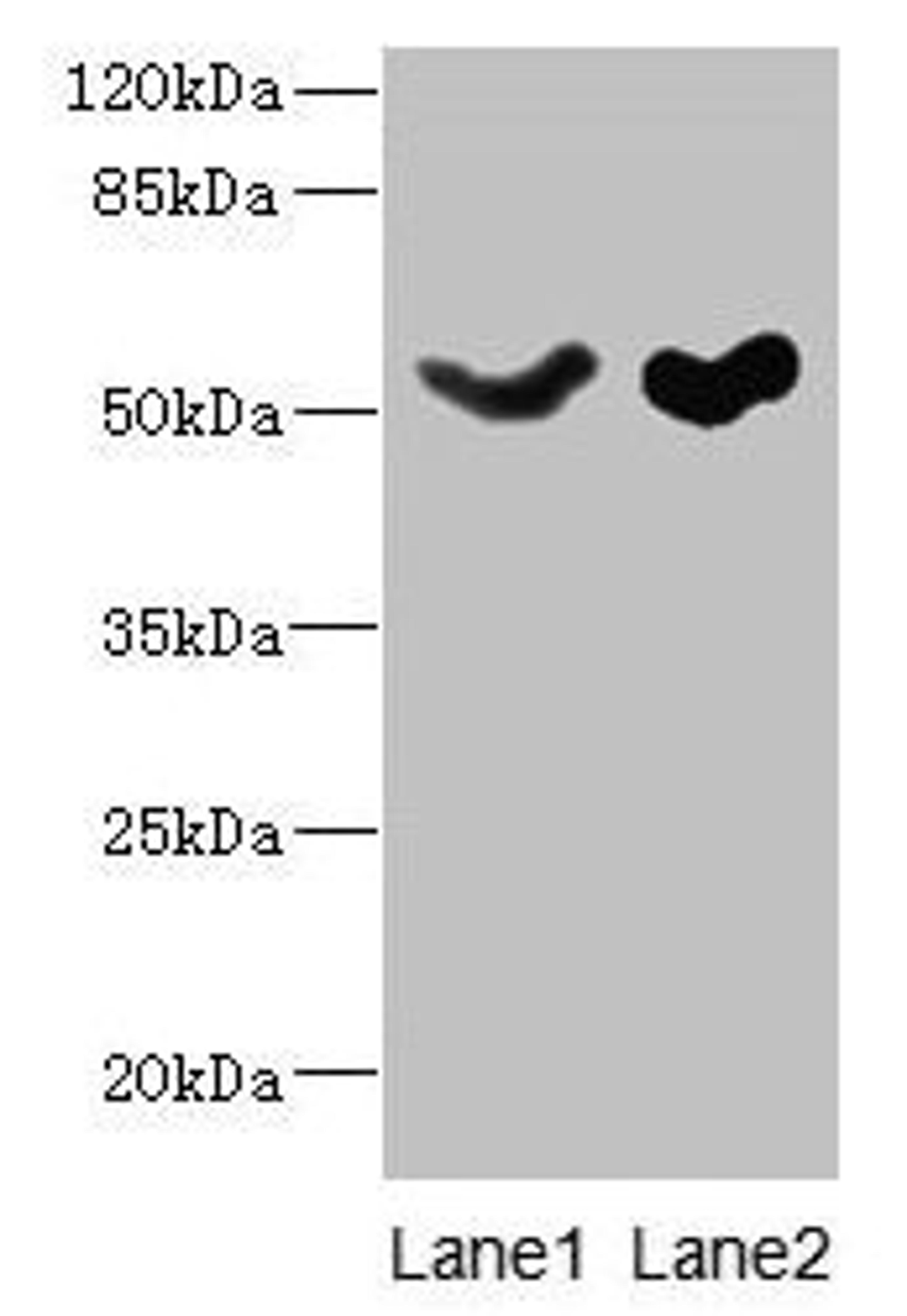 Western blot. All lanes: SLC25A25 antibody at 10µg/ml. Lane 1: Mouse liver tissue. Lane 2: Mouse brain tissue. Secondary. Goat polyclonal to rabbit IgG at 1/10000 dilution. Predicted band size: 53, 56, 57, 55, 41 kDa. Observed band size: 53 kDa