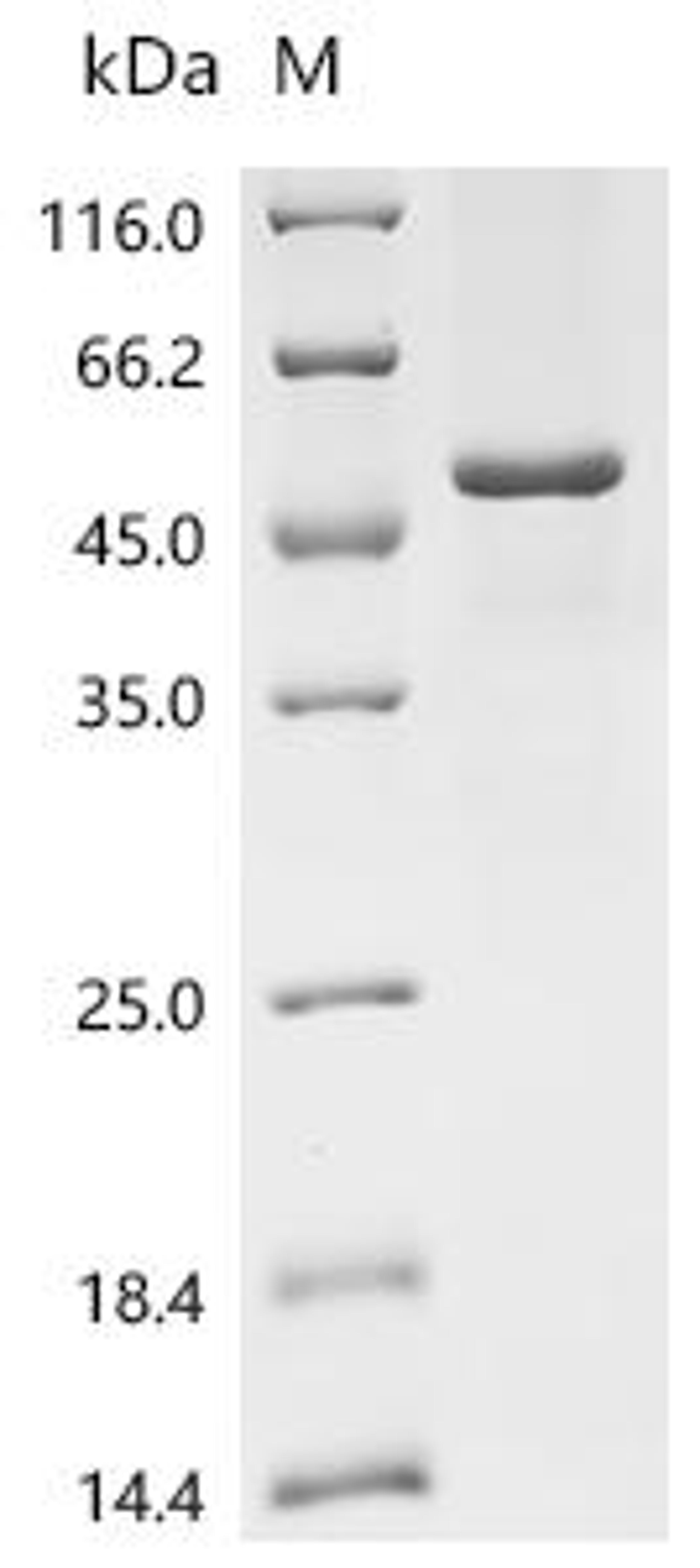 (Tris-Glycine gel) Discontinuous SDS-PAGE (reduced) with 5% enrichment gel and 15% separation gel.