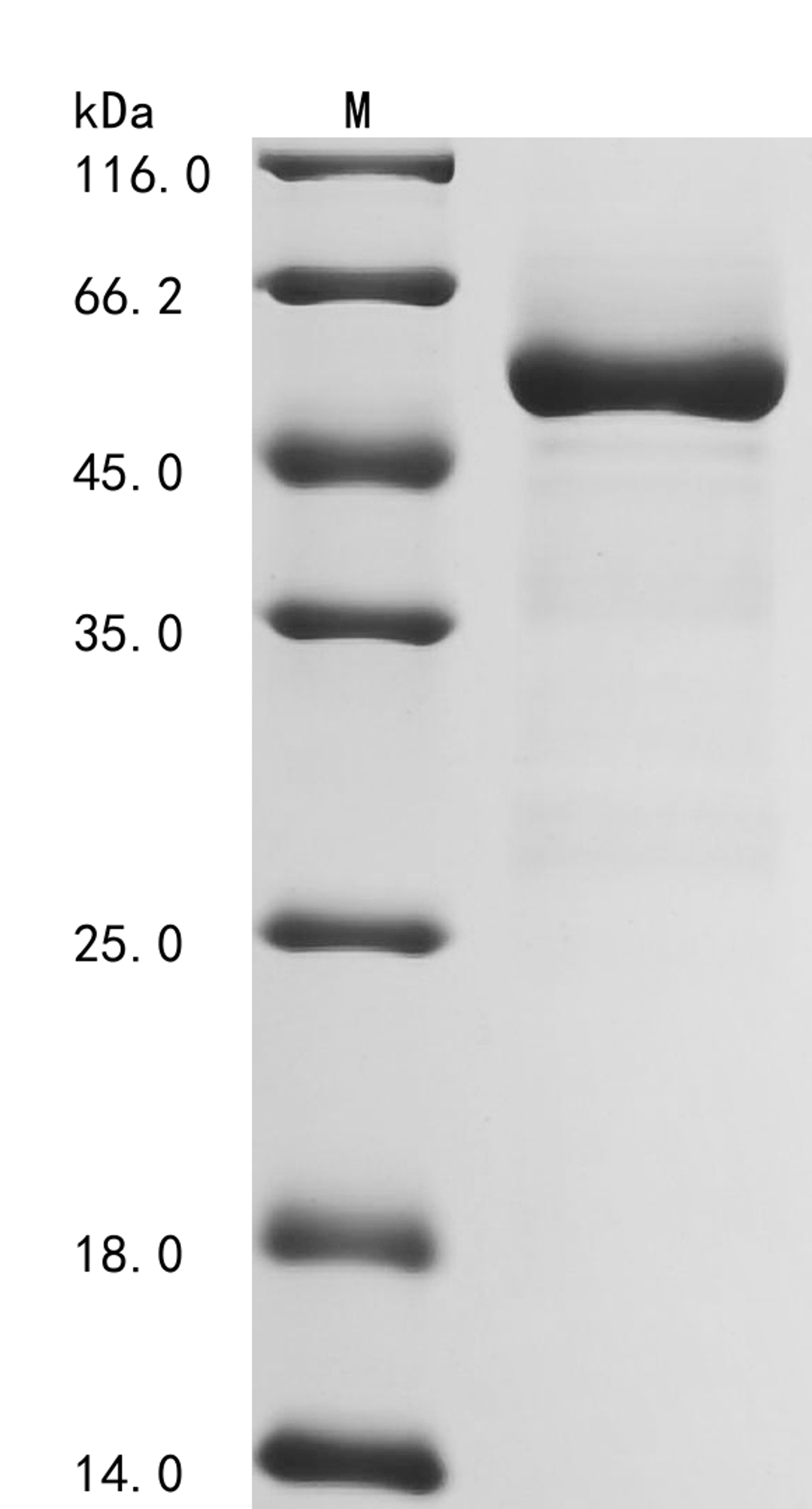 (Tris-Glycine gel) Discontinuous SDS-PAGE (reduced) with 5% enrichment gel and 15% separation gel.