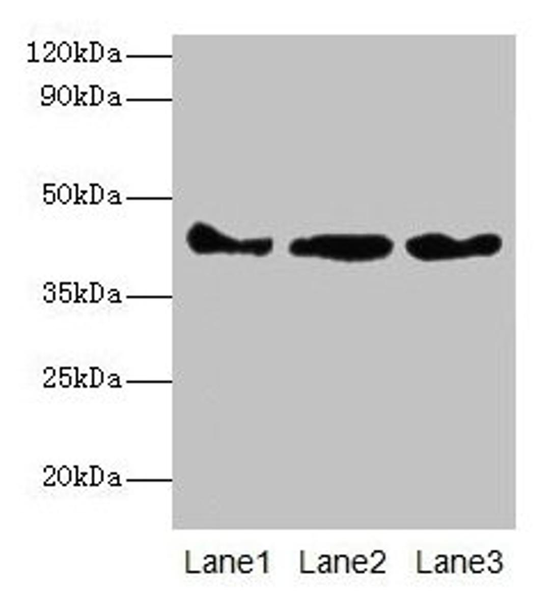Western blot. All lanes: Actb antibody at 2µg/ml. Lane 1: Mouse spleen tissue. Lane 2: 293T whole cell lysate. Lane 3: Hela whole cell lysate. Secondary. Goat polyclonal to rabbit IgG at 1/10000 dilution. Predicted band size: 42 kDa. Observed band size: 42 kDa