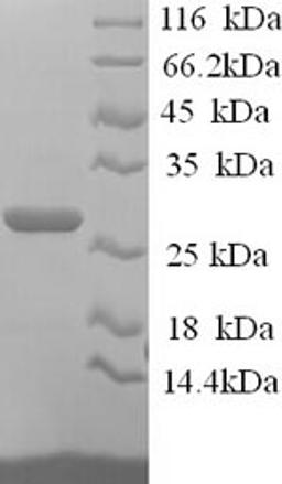 (Tris-Glycine gel) Discontinuous SDS-PAGE (reduced) with 5% enrichment gel and 15% separation gel.