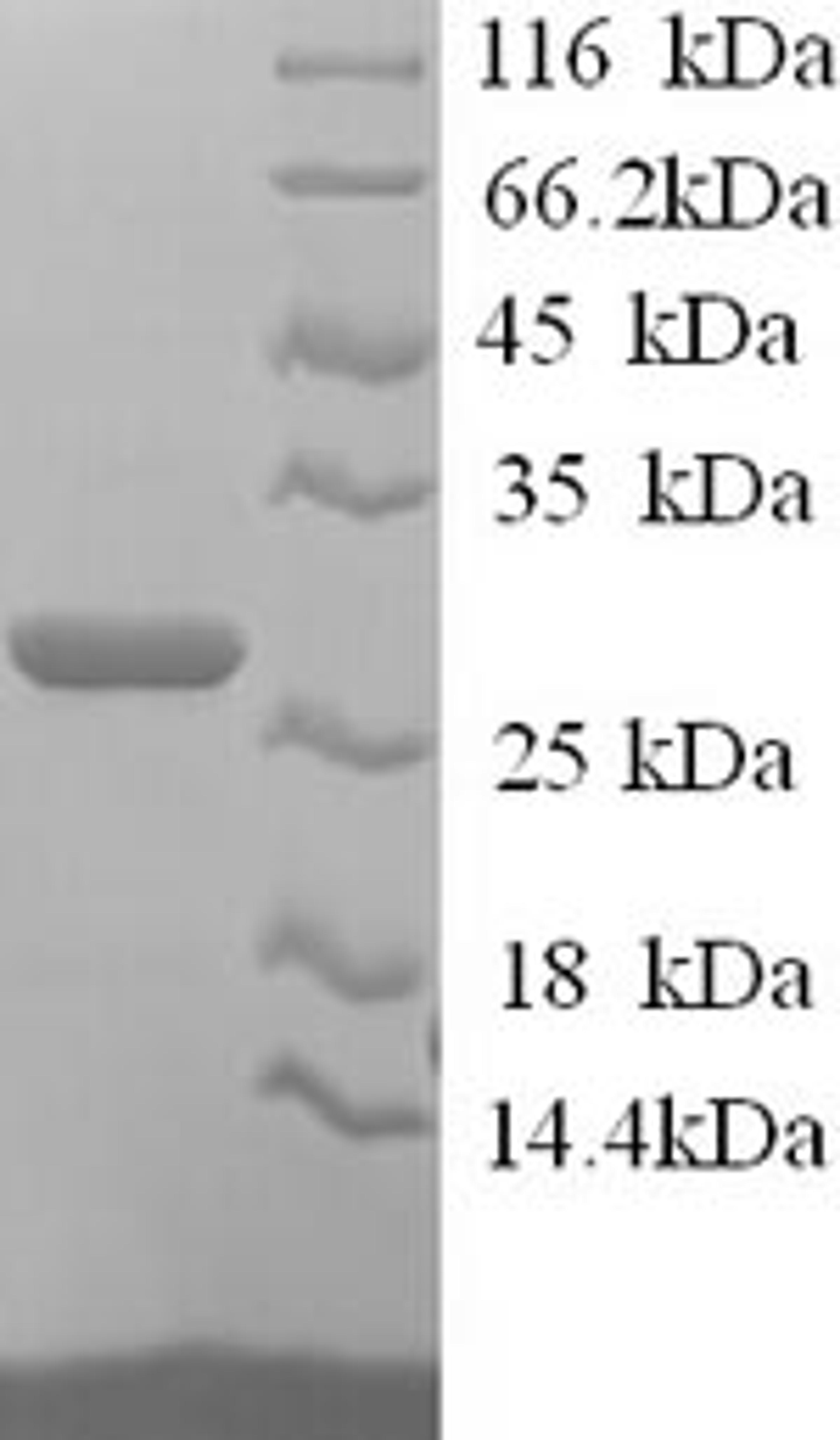 (Tris-Glycine gel) Discontinuous SDS-PAGE (reduced) with 5% enrichment gel and 15% separation gel.