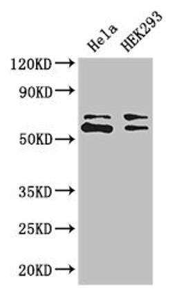 Western Blot. Positive WB detected in: Hela whole cell lysate, HEK293 whole cell lysate. All lanes: COASY antibody at 3.4ug/ml. Secondary. Goat polyclonal to rabbit IgG at 1/50000 dilution. Predicted band size: 63, 66 kDa. Observed band size: 63, 66 kDa. 