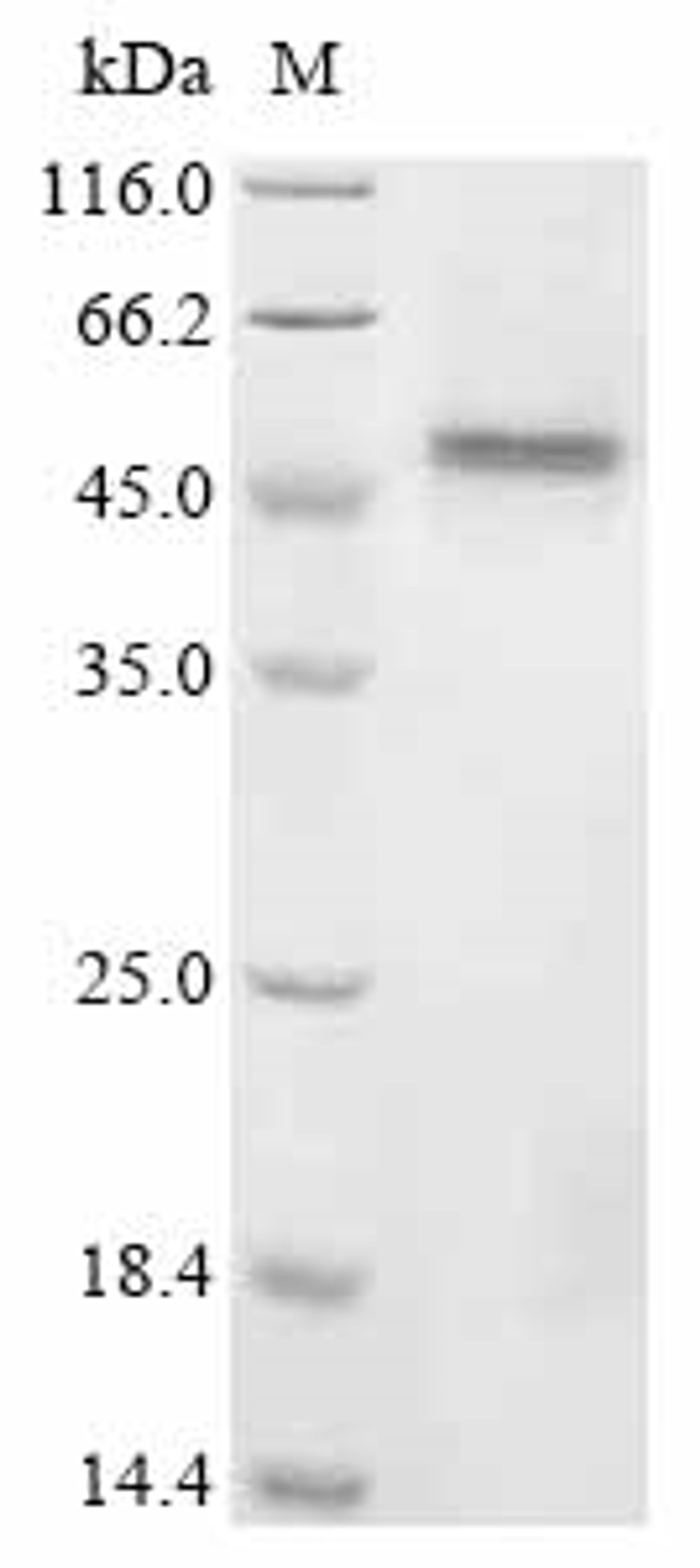 (Tris-Glycine gel) Discontinuous SDS-PAGE (reduced) with 5% enrichment gel and 15% separation gel.