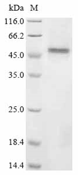 (Tris-Glycine gel) Discontinuous SDS-PAGE (reduced) with 5% enrichment gel and 15% separation gel.