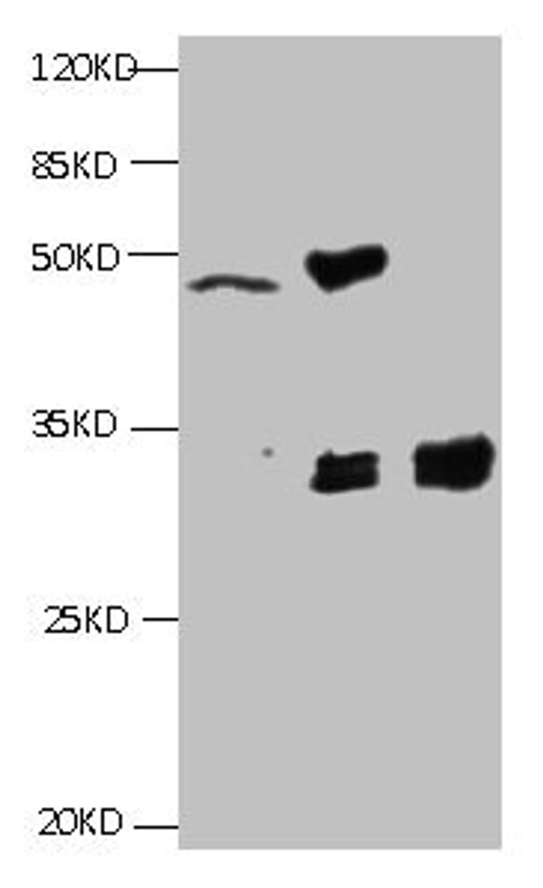 All lanes:Mouse anti-Human Cyfra21-1(KS19.1) monoclonal antibody at 4ug/ml. Lane 1: MCF7 cell lysate. Lane2: MDA-MB-231 cell lysate. Lane3: HepG-2 cell lysate. Secondary HRP labeled Goat polyclonal to Mouse IgG at 1/3000 dilution. Predicted band size : 30 kDa. Observed band size : 32 kDa. Additional bands at: 50kd. 