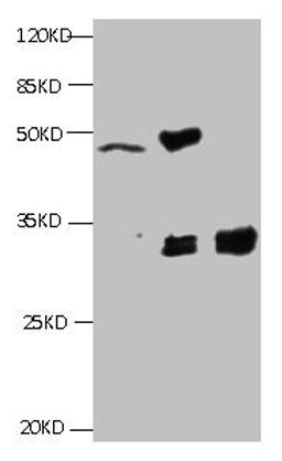 All lanes:Mouse anti-Human Cyfra21-1(KS19.1) monoclonal antibody at 4ug/ml. Lane 1: MCF7 cell lysate. Lane2: MDA-MB-231 cell lysate. Lane3: HepG-2 cell lysate. Secondary HRP labeled Goat polyclonal to Mouse IgG at 1/3000 dilution. Predicted band size : 30 kDa. Observed band size : 32 kDa. Additional bands at: 50kd. 