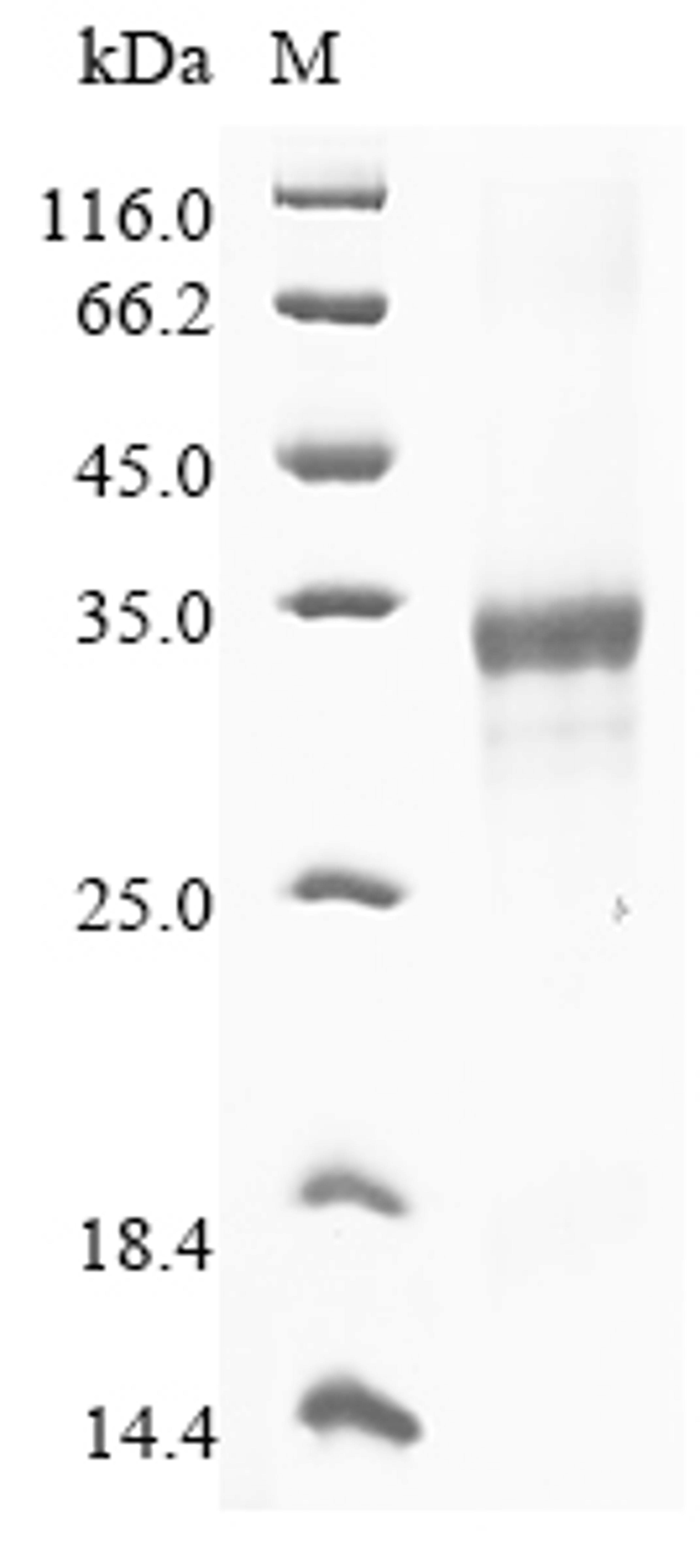 (Tris-Glycine gel) Discontinuous SDS-PAGE (reduced) with 5% enrichment gel and 15% separation gel.
