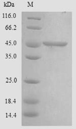 (Tris-Glycine gel) Discontinuous SDS-PAGE (reduced) with 5% enrichment gel and 15% separation gel.