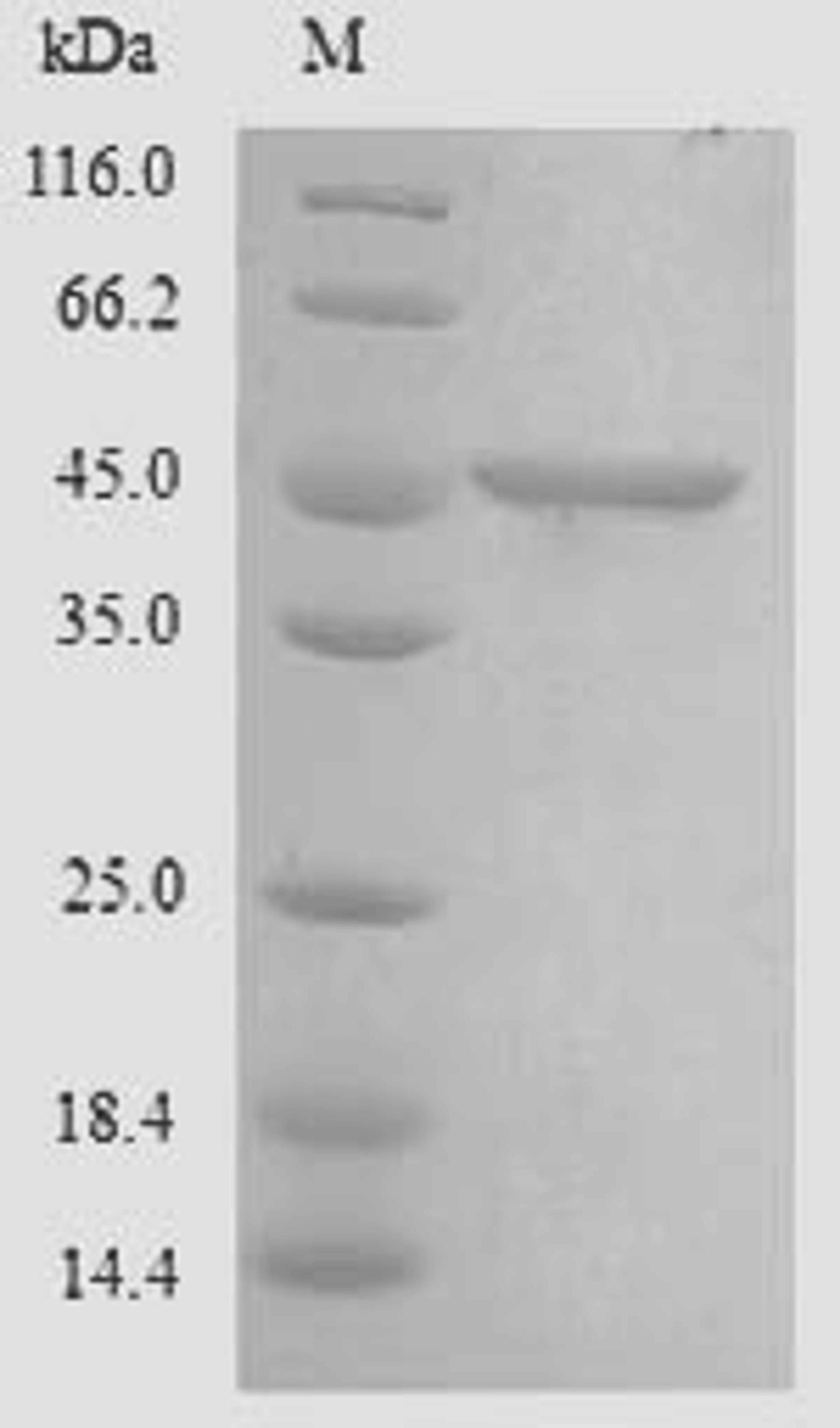 (Tris-Glycine gel) Discontinuous SDS-PAGE (reduced) with 5% enrichment gel and 15% separation gel.
