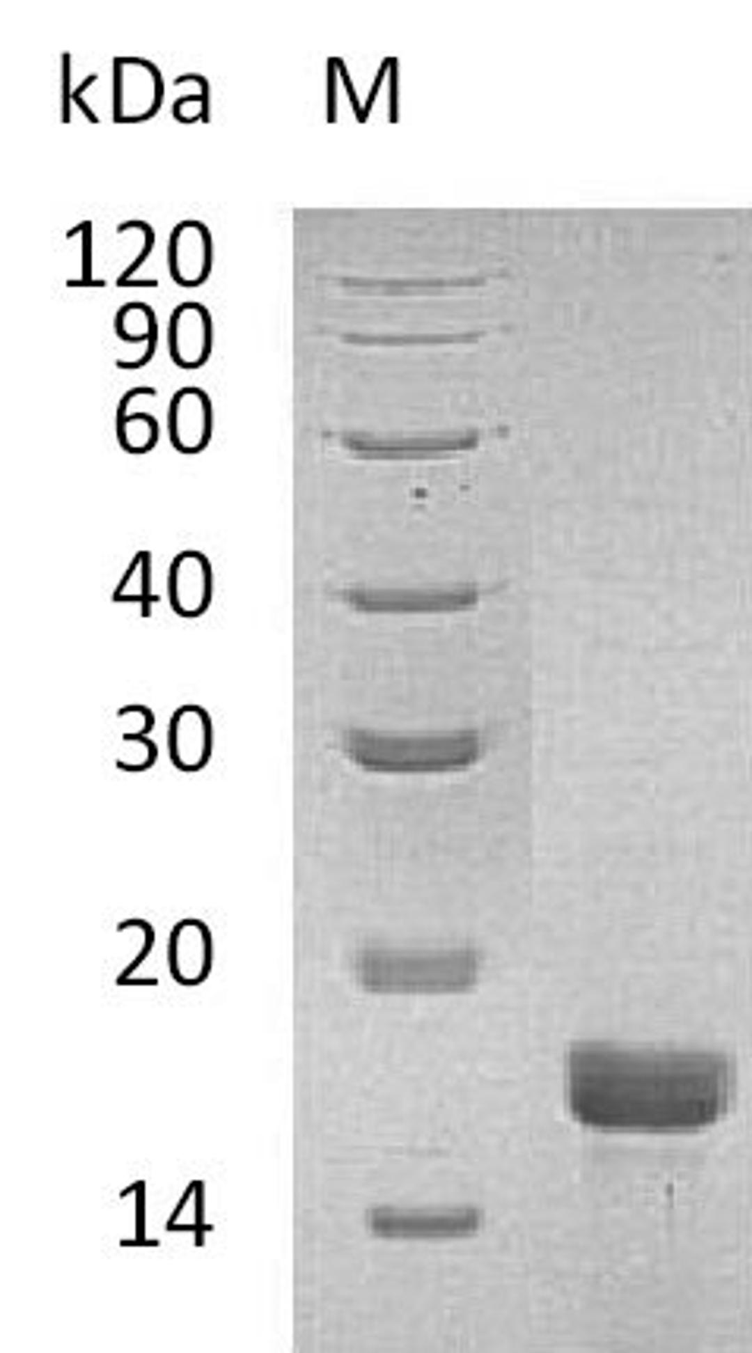 (Tris-Glycine gel) Discontinuous SDS-PAGE (reduced) with 5% enrichment gel and 15% separation gel.