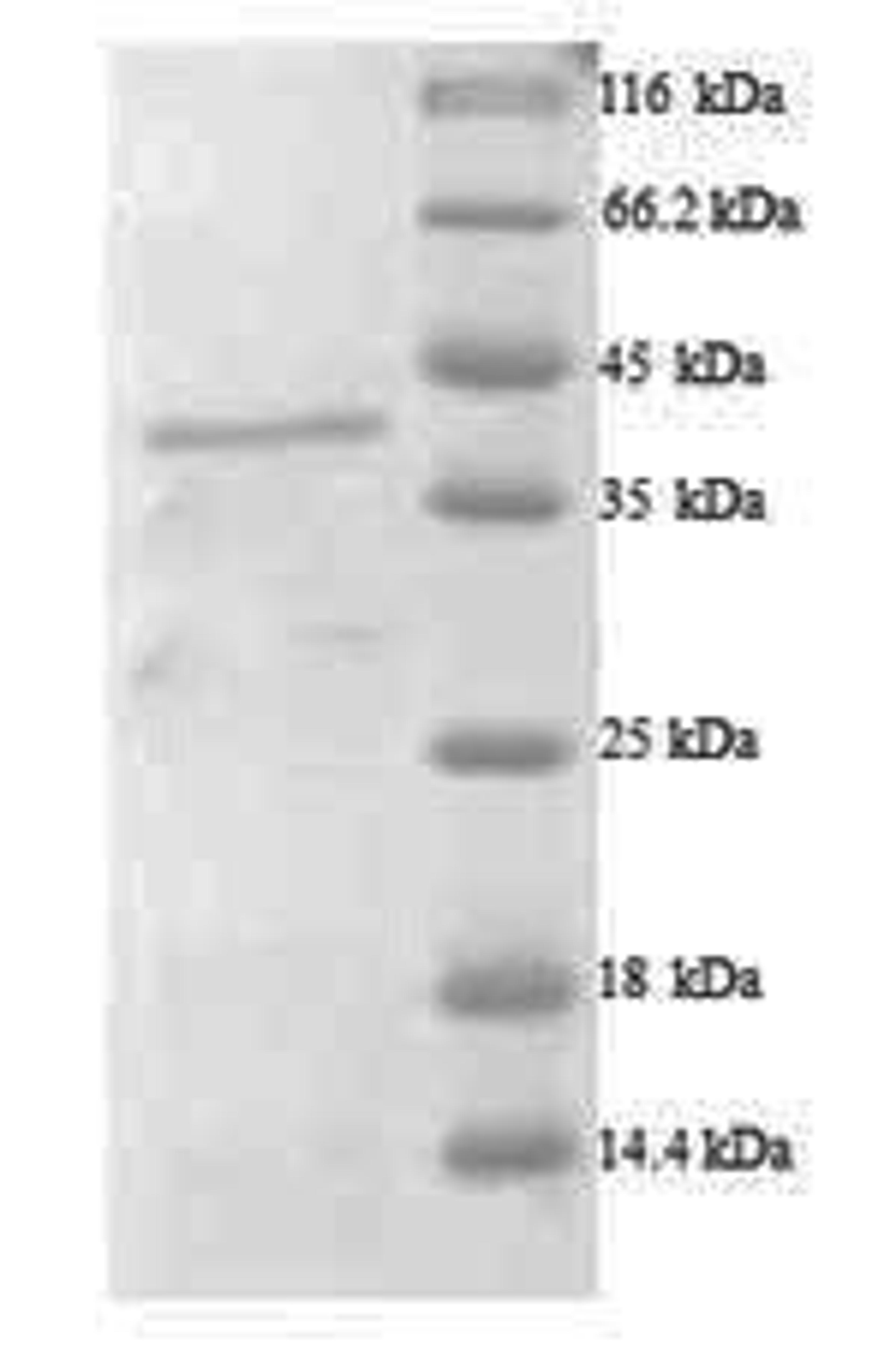 (Tris-Glycine gel) Discontinuous SDS-PAGE (reduced) with 5% enrichment gel and 15% separation gel.