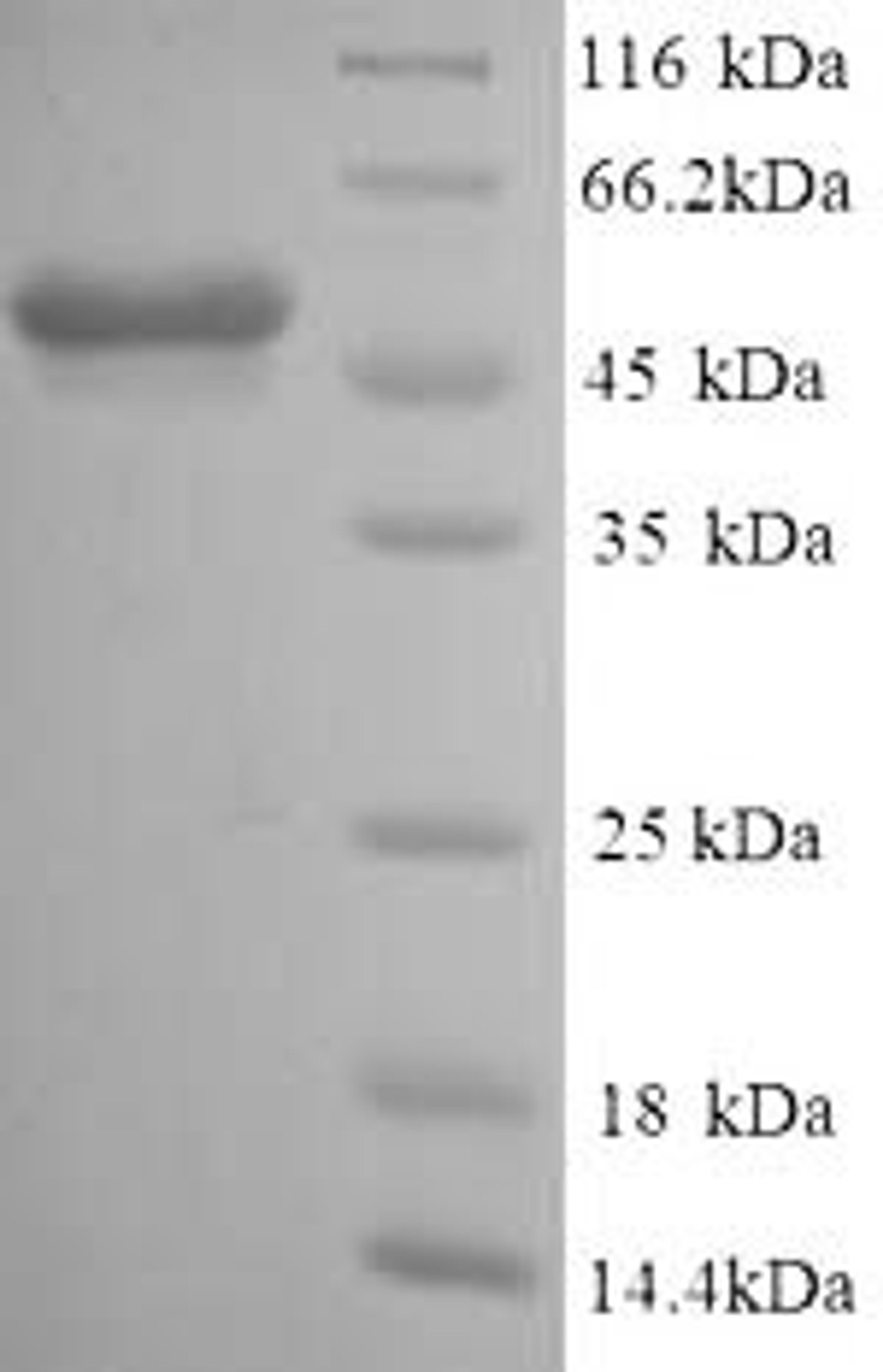(Tris-Glycine gel) Discontinuous SDS-PAGE (reduced) with 5% enrichment gel and 15% separation gel.