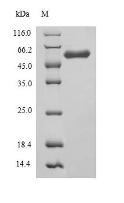 (Tris-Glycine gel) Discontinuous SDS-PAGE (reduced) with 5% enrichment gel and 15% separation gel.