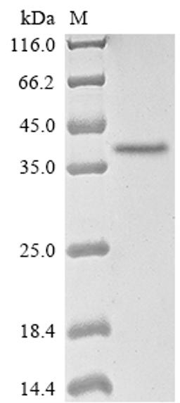 (Tris-Glycine gel) Discontinuous SDS-PAGE (reduced) with 5% enrichment gel and 15% separation gel.