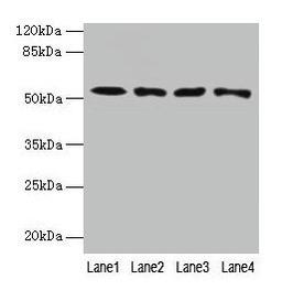 Western blot. All lanes: CAP2 antibody at 4µg/ml. Lane 1: HepG2 whole cell lysate. Lane 2: Mouse muscle tissue. Lane 3: Mouse gonadal tissue. Lane 4: Hela whole cell lysate. Secondary. Goat polyclonal to rabbit IgG at 1/10000 dilution. Predicted band size: 53, 46, 25 kDa. Observed band size: 53 kDa
