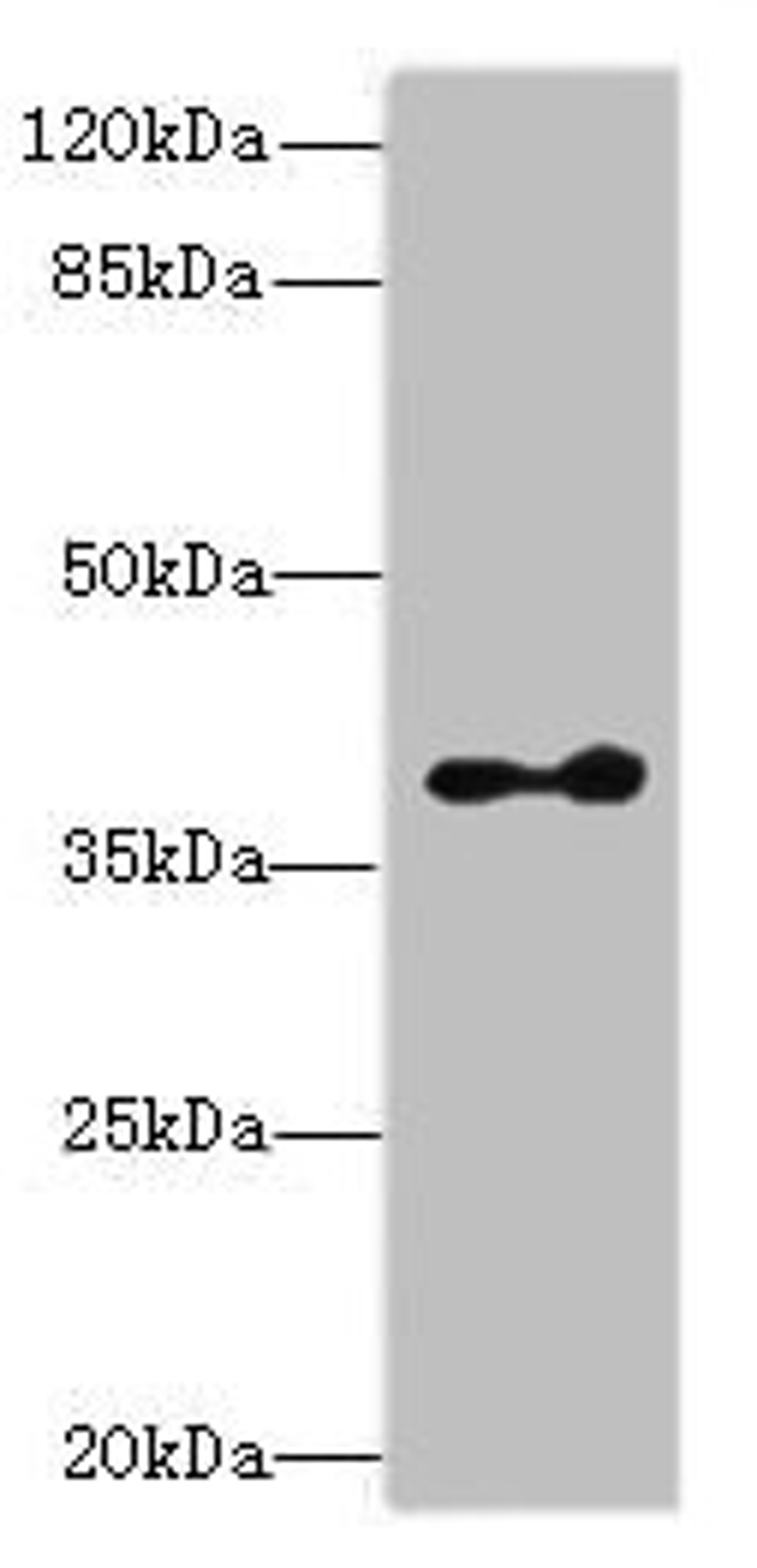 Western blot. All lanes: CLVS2 antibody at 16µg/ml + Mouse brain tissue. Secondary. Goat polyclonal to rabbit IgG at 1/10000 dilution. Predicted band size: 38, 22 kDa. Observed band size: 38 kDa