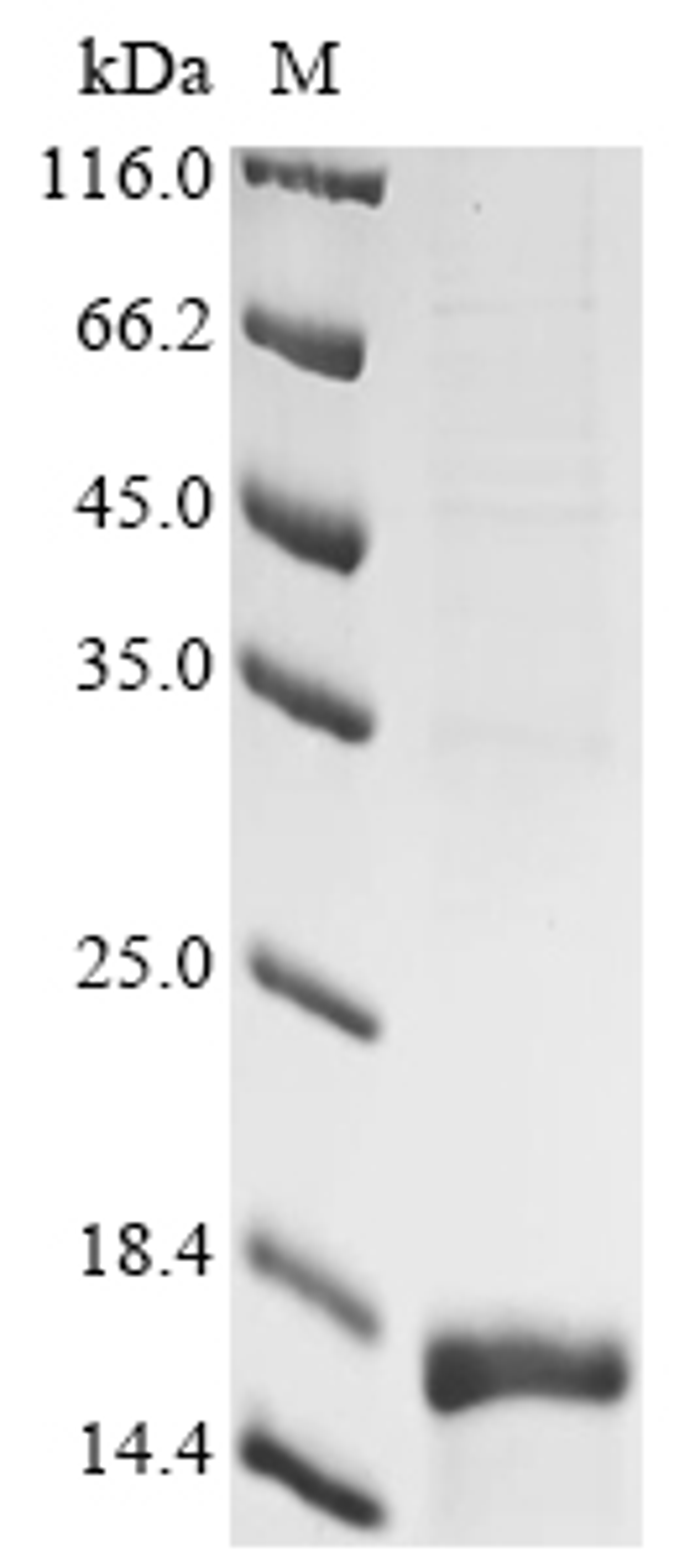 (Tris-Glycine gel) Discontinuous SDS-PAGE (reduced) with 5% enrichment gel and 15% separation gel.