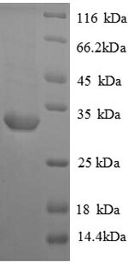 (Tris-Glycine gel) Discontinuous SDS-PAGE (reduced) with 5% enrichment gel and 15% separation gel.