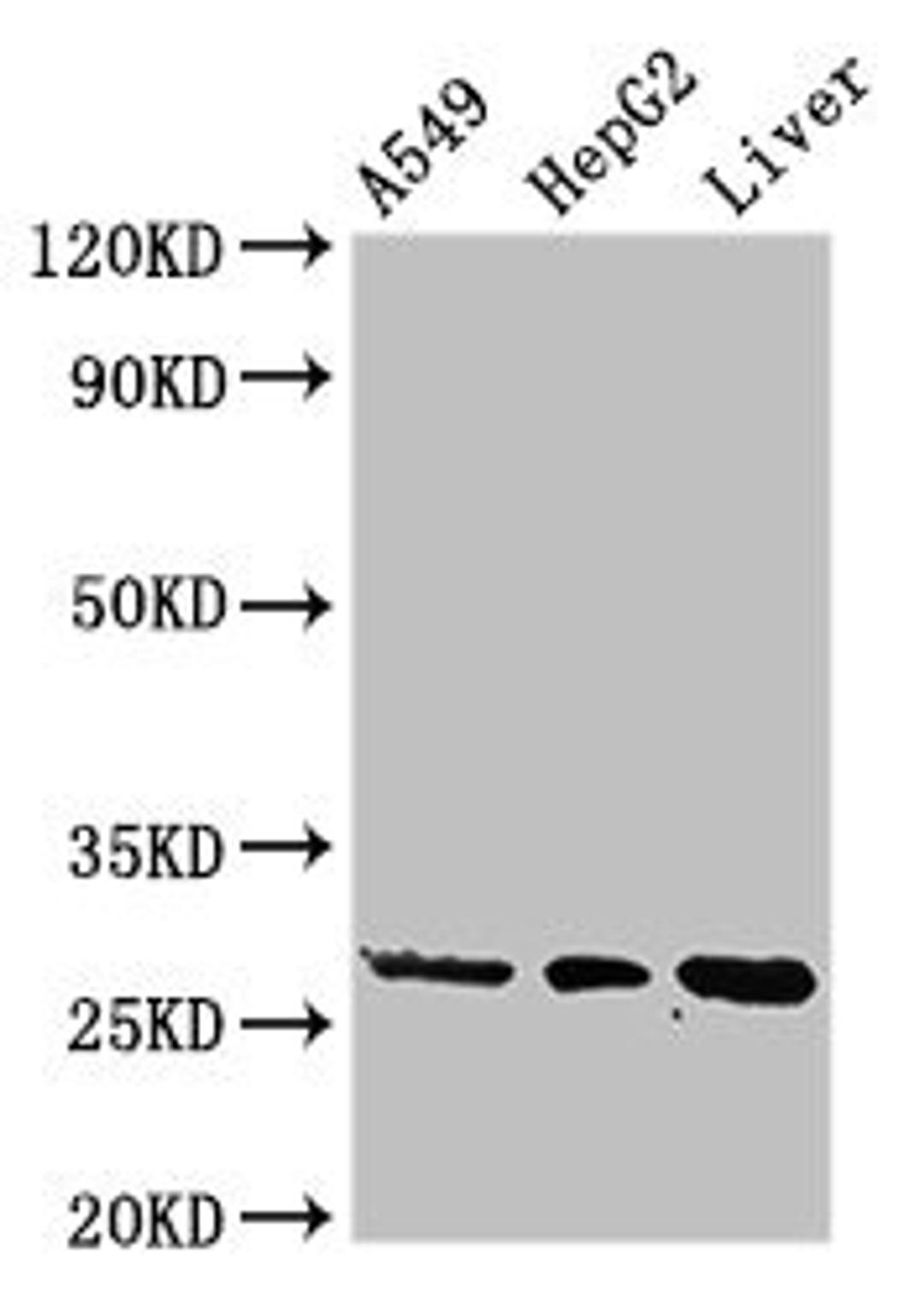 Western Blot. Positive WB detected in: A549 whole cell lysate, HepG2 whole cell lysate, Rat liver tissue. All lanes: PSMA5 antibody at 3ug/ml. Secondary. Goat polyclonal to rabbit IgG at 1/50000 dilution. Predicted band size: 27, 21 kDa. Observed band size: 27 kDa. 