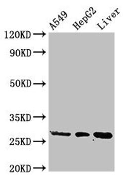 Western Blot. Positive WB detected in: A549 whole cell lysate, HepG2 whole cell lysate, Rat liver tissue. All lanes: PSMA5 antibody at 3ug/ml. Secondary. Goat polyclonal to rabbit IgG at 1/50000 dilution. Predicted band size: 27, 21 kDa. Observed band size: 27 kDa. 
