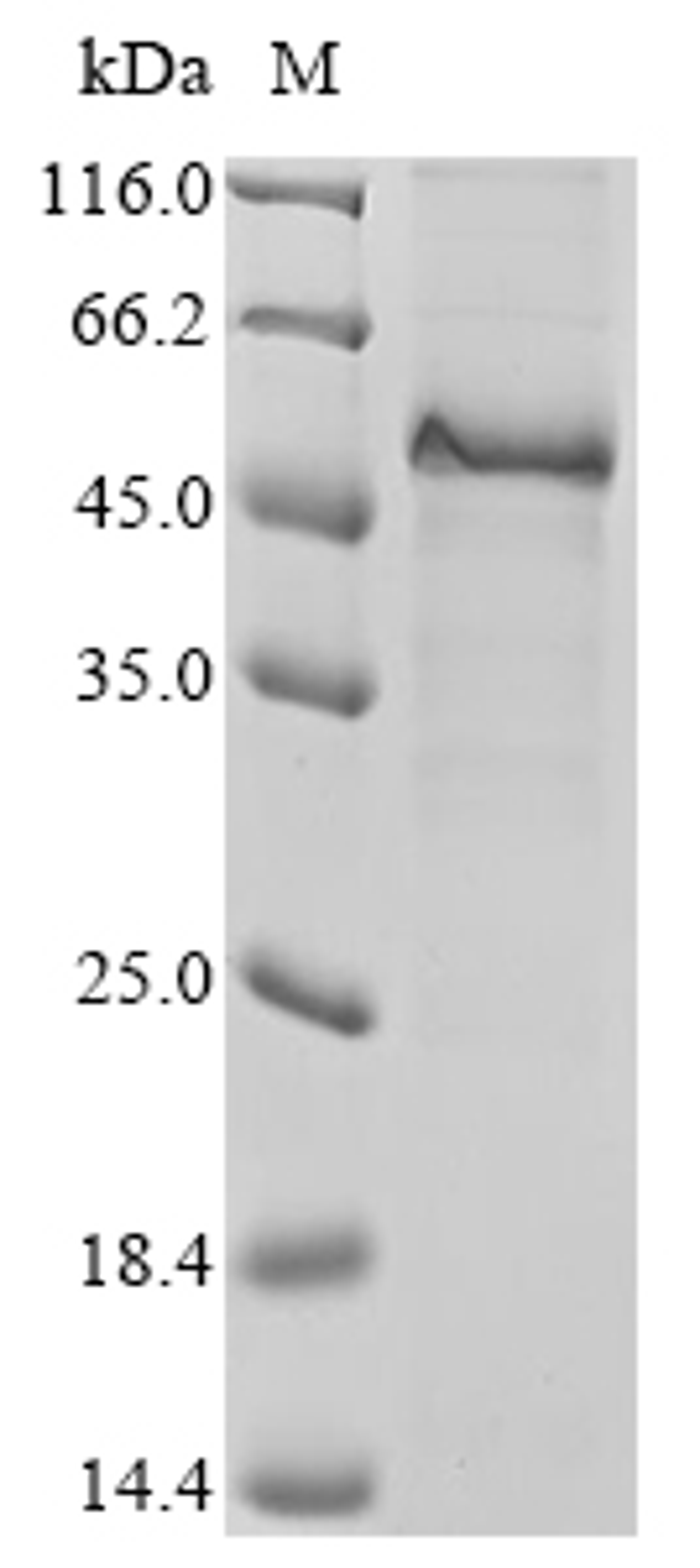 (Tris-Glycine gel) Discontinuous SDS-PAGE (reduced) with 5% enrichment gel and 15% separation gel.