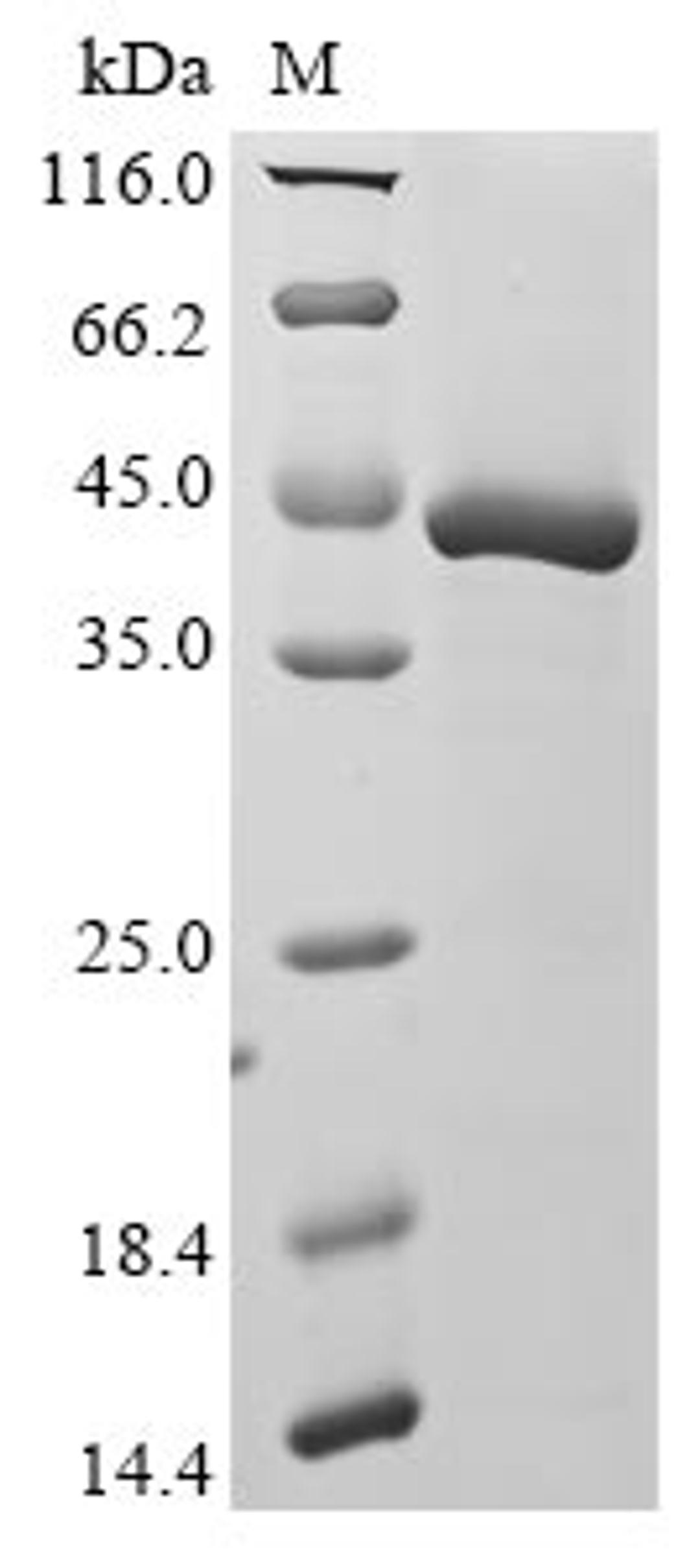 (Tris-Glycine gel) Discontinuous SDS-PAGE (reduced) with 5% enrichment gel and 15% separation gel.